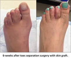 Try our symptom checker got any ot. Facebook