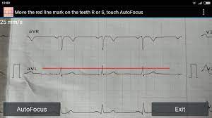 2) complete the onboarding process. Ecg Reader Free For Android Apk Download