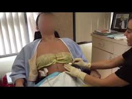 Pin On Mastectomy Reconstruction