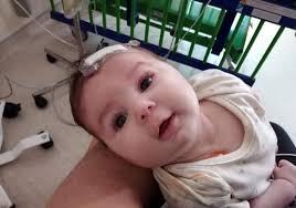 Rishton mum's 'worst nightmare' as baby girl battles meningitis