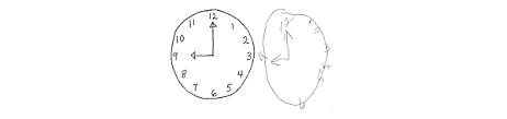 The clock drawing test is a cognitive screening tool gaining popularity in the perioperative setting. Clock Drawing Test Cdt Strokengine