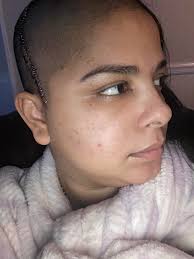 Help my daughter sharing and supporting for her surgery please, thank and  God bless you all🙏🏼🤗