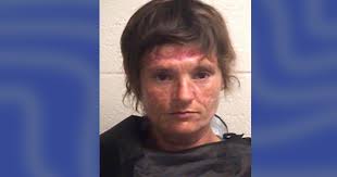 South Carolina woman who lost both arms after dog attack arrested