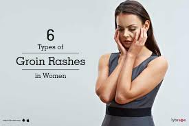 6 Types Of Groin Rashes In Women