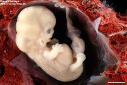 Schwangerschaftswoche ganz normal sind und bei welchen du lieber einen arzt aufsuchen solltest. Entwicklung Zwillinge Im 3 Monat Ssw 9 Babywelten Ch