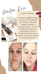 Wpc 509 Hi friends I have made a new batch of anti aging face cream. Made  with 100 percent rose hydrosol , sea buckthorn oil , argan oil , rosehip  oil ,