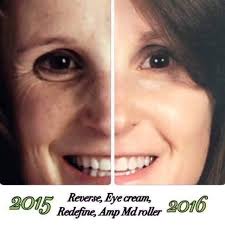 There are 8 years difference in these pictures and no foundation in Kelly's  current picture. This is what consistent use of good skincare can do for  your skin!!!