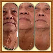 使用漫妮青春定格原液后，效果令人意想不到的惊喜！ 联络/contact：Sally Leong Seow Keng （绣琴）  电话：6017-3106227 微信/ wechat: sallyleong1283 联络/contact：Carmen Tam (香港）  电话：852-61343668 微信/ wechat: carmen-ray 联络/contact：Jane Lai 电话：6010 ...