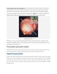 Cara mengatasi penyakit sipilis pada pria. Gejala Penyakit Sipilis Dan Pengobatannya By Omay Chanel Issuu