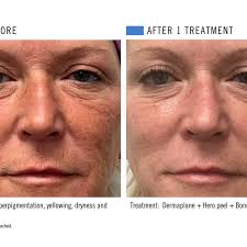 Esthetics By Natalye