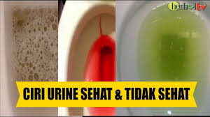 Maybe you would like to learn more about one of these? Kenali Ciri Urine Sehat Dan Tidak Sehat Sudahkah Urine Anda Sehat Youtube