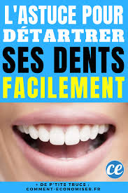 L Astuce Surprenante Pour Detartrer Ses Dents Facilement A La Maison Detartrage Des Dents Tartre Dentaire Blanchir Les Dents Naturellement