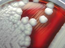 Enteral nutrition, which is defined as nutritional support given via the alimentary canal or any route connected to the gastrointestinal system (i.e., the enteral route).this includes oral feeding, sip feeding, and tube feeding using nasogastric, gastrostomy, and jejunostomy tubes. Bacillus Cereus Wikipedia