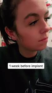 Am I the only 21 year old with baby teeth. Like for part ✌🏼 with me