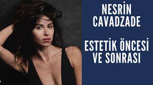 Estetikli ya da estetiksiz ayrımı yapmadan. Nesrin Cavadzade Estetik Oncesi Ve Sonrasi Youtube
