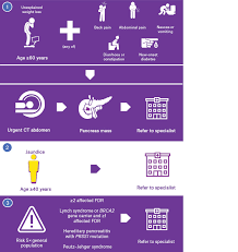 Symptoms of pancreatic cancer can include: Racgp Pancreatic Cancer