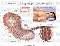 Ensure that pelvis and thorax are not rotated but are in a true lateral position. Lateral Recumbent Position Anatomy