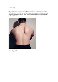 Image result for Winged Scapula
