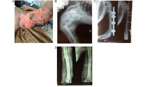 A Clinical Picture At The Time Of Presentation To Emergency B Download Scientific Diagram