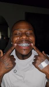 Custom Grillz Orlando