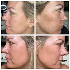 SEINT product giveaway