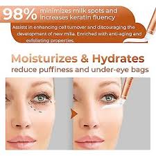 Silmänympärysvoide poistaa maitopisteitä, kiinteyttävä ryppyjä kirkastava  silmänympärysvoide tummille silmänalusille, vähentää