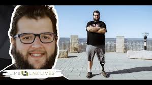 GAO Report Overview & Connecting Patients to Care with the Amputee  Coalition