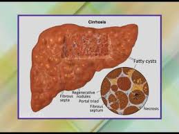 Liver Function Test Lft And Kidney Function Test Kft Youtube