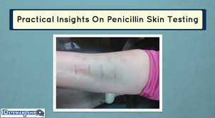 Image result for Skin Testing