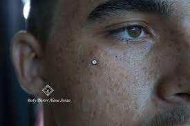 Microdermal Microdermal
