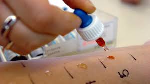 We did not find results for: Seltene Allergien Und Ihre Ausloser Swr1