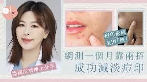 痘印消不掉？皮膚博士教2招去痘印方法！一個月擊退黑色素、痘印