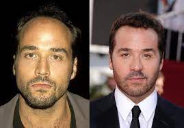 Lean meats, olive oil and avocado oil from fresh in general, if anyone is experiencing lots of hair loss i also recommend using volumizing products. What Do Male Celebrities Do To Prevent Baldness Quora