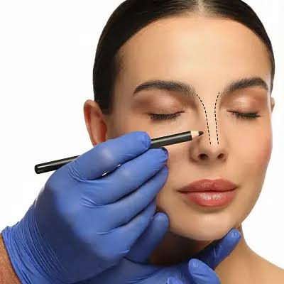 Alarplasty in Dubai | Advanced Nostril Reduction Surgery
