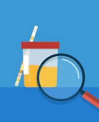 Urine Culture What Is It And How Do You Prepare