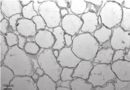 In this video i will show you 8 ordinary things that appear amazing under a powerful microscope. Cell Cross Sections From A Thin Layer Of Fresh Strawberry Tissue 540 Download Scientific Diagram