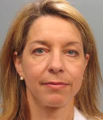 Eyelid Surgery Before and After Photos by Gregory Mackay, MD; Atlanta, GA