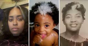 Baby born with rare birthmark which means he has a white streak of hair