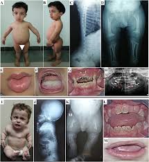 Image result for Orthopichonia