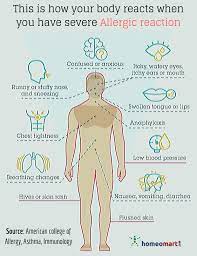 Best Allergy Relief Remedies In Homeopathy Homeopathic Medicine Homeopathic Allergy Medicine Allergy Medicine