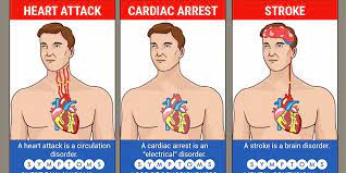 But heart attack, cardiac arrest, and heart failure aren't the same thing. What Is The Difference Between Stroke And Heart Attack Apollo Hospitals Blog