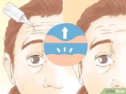 Updated on january 27th, 2020. 4 Ways To Get Rid Of Forehead Wrinkles Wikihow