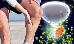 Your partner, family or friends might also find it helpful. Prostate Cancer Symptoms Signs Of Tumour Include Numbness In Legs Express Co Uk