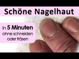 Fußnägel können sich sehr vielfältig verformen: Schone Nagelhaut In 5 Minuten Ohne Schneiden Youtube