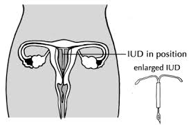 The human male reproductive system consists of a scrotum, testes, testicular lobules, seminiferous tubules, urethra, and penis. Stages Of Reproduction Human Reproduction Siyavula
