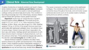 From french gigantisme, from latin gigans (giant). Abnormal Bone Development Gigantism And Marfan S Syndrome Anatomy And Physiology Physiology Growth Hormone
