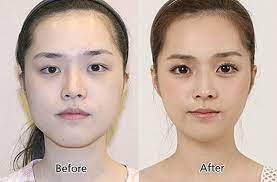 We've heard a lot about the north korea nuclear threat, and how the kim dynasty has declared war on the us. Korean Beauty Standards Another Pressure Point Koreabridge