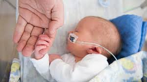 Image result for Preterm Infant