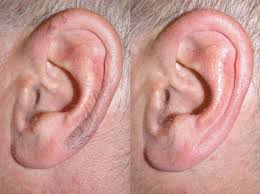 Short wavelengths of light are emitted into the targeted treatment areas. Ear Hair Function Ear Hair Removal Techniques