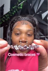 Wie Kann Man Fake Zahnspange Machen Zu Hause